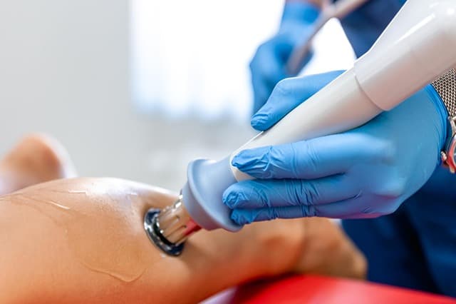 Vein Treatment: IPL For Veins