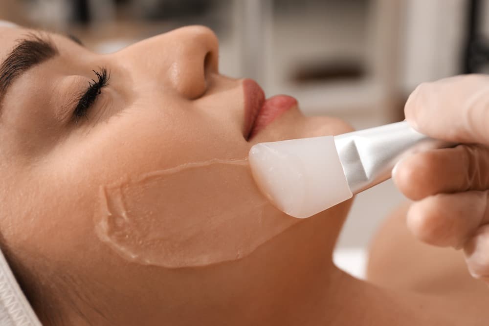 Chemical peel treatment at Harmony Med Spa